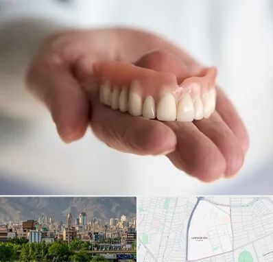 لیفت لثه با لیزر در جمشیدیه