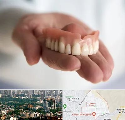 لیفت لثه با لیزر در عظیمیه کرج 