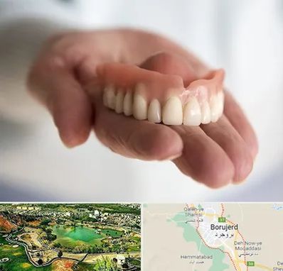 لیفت لثه با لیزر در بروجرد