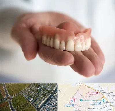 لیفت لثه با لیزر در الهیه مشهد