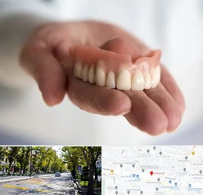 لیفت لثه با لیزر در میرداماد