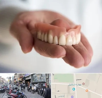 لیفت لثه با لیزر در چهارراه استانبول