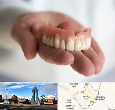 لیفت لثه با لیزر در تایباد