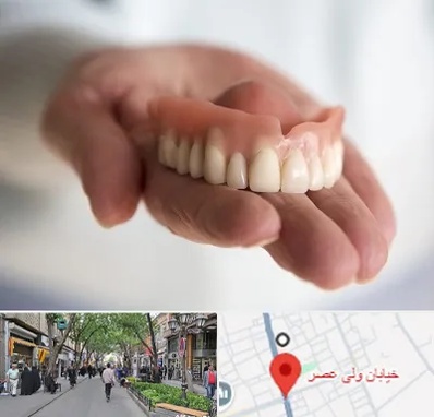 لیفت لثه با لیزر در ولیعصر شهریار