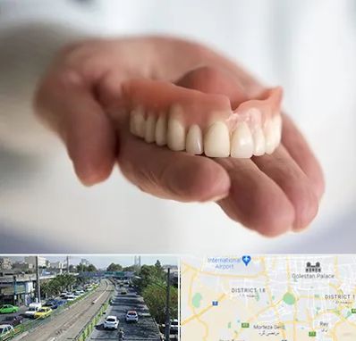 لیفت لثه با لیزر در جنوب تهران 