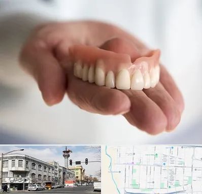 لیفت لثه با لیزر در 17شهریور