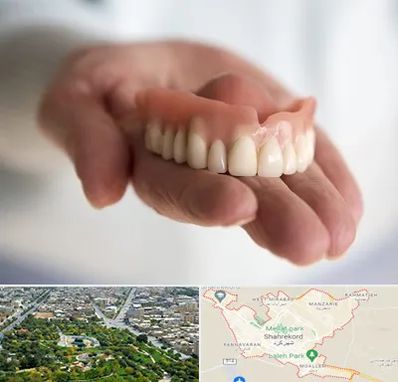 لیفت لثه با لیزر در شهرکرد