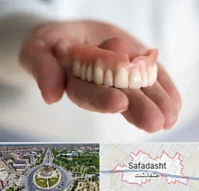 لیفت لثه با لیزر در صفادشت