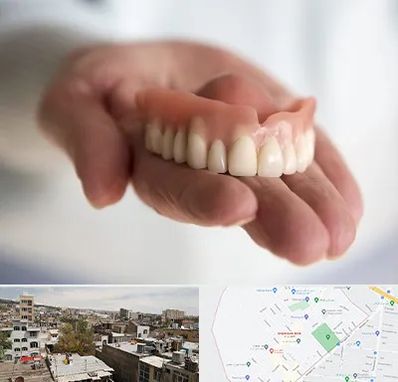 لیفت لثه با لیزر در شمیران نو