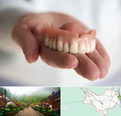 لیفت لثه با لیزر در فومن