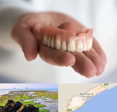 لیفت لثه با لیزر در بندرلنگه