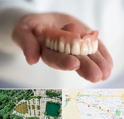 لیفت لثه با لیزر در وکیل آباد مشهد