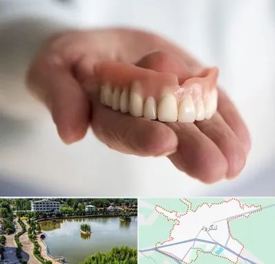 لیفت لثه با لیزر در لنگرود
