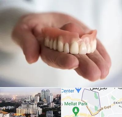 لیفت لثه با لیزر در الهیه 