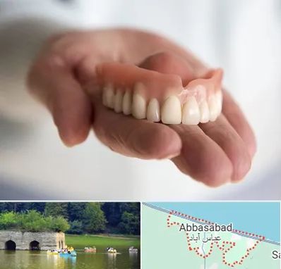 لیفت لثه با لیزر در عباس آباد