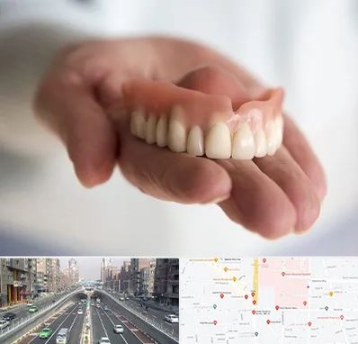 لیفت لثه با لیزر در توحید