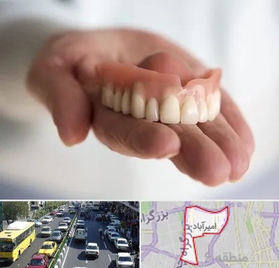 لیفت لثه با لیزر در امیرآباد