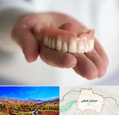 لیفت لثه با لیزر در خراسان شمالی