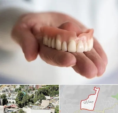 لیفت لثه با لیزر در جماران