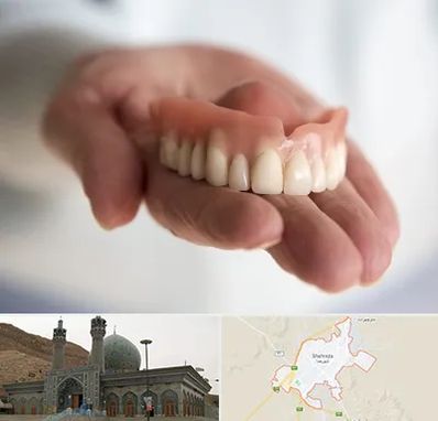 لیفت لثه با لیزر در شهرضا