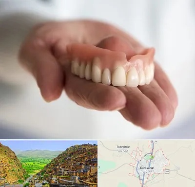 لیفت لثه با لیزر در کامیاران