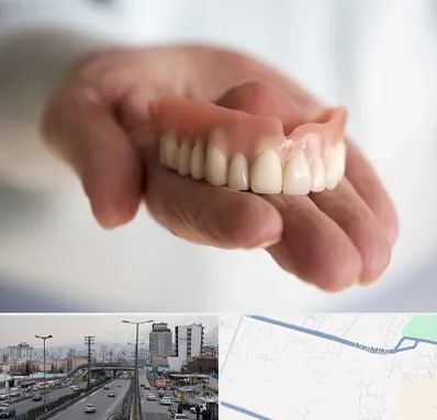 لیفت لثه با لیزر در بلوار ارتش