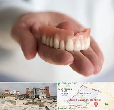 لیفت لثه با لیزر در حکیمیه 