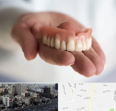لیفت لثه با لیزر در زرتشت