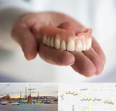 لیفت لثه با لیزر در میدان خراسان