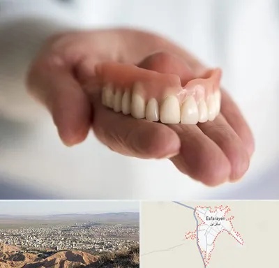 لیفت لثه با لیزر در اسفراین