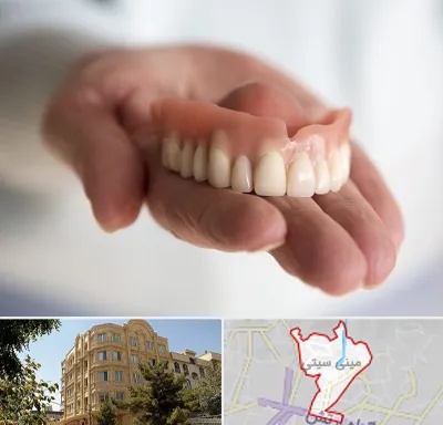 لیفت لثه با لیزر در مینی سیتی