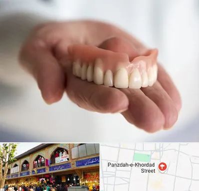 لیفت لثه با لیزر در 15 خرداد