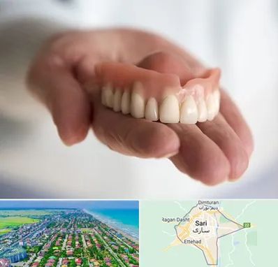 لیفت لثه با لیزر در ساری