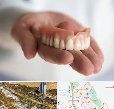 لیفت لثه با لیزر در خیابان نیایش شیراز