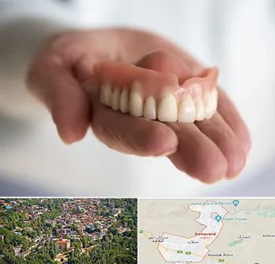 لیفت لثه با لیزر در دماوند