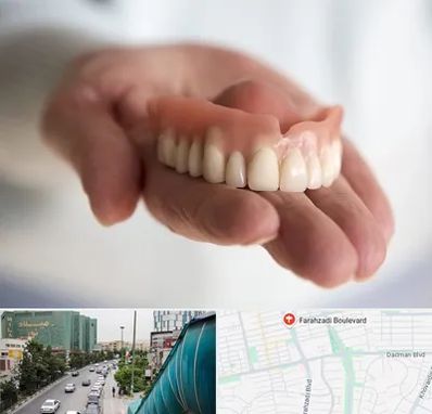 لیفت لثه با لیزر در بلوار فرحزادی