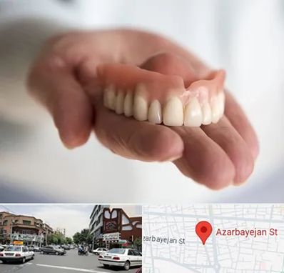 لیفت لثه با لیزر در خیابان آذربایجان