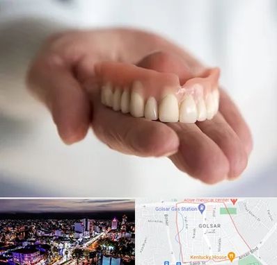 لیفت لثه با لیزر در گلسار رشت 