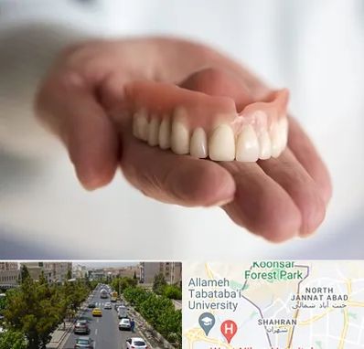 لیفت لثه با لیزر در شهران 