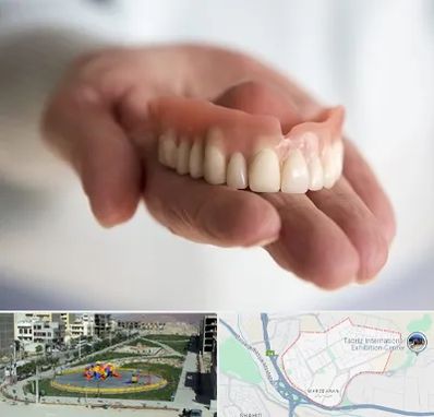 لیفت لثه با لیزر در مرزداران تبریز