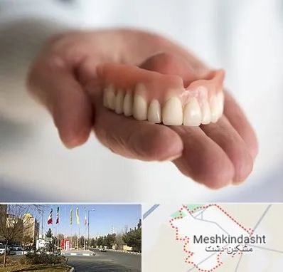 لیفت لثه با لیزر در مشکین دشت