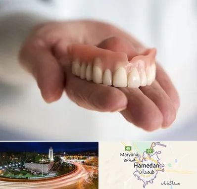 لیفت لثه با لیزر در همدان