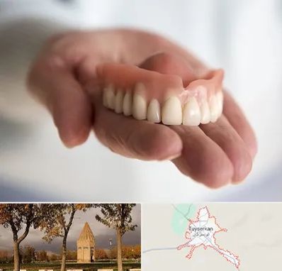 لیفت لثه با لیزر در تویسرکان