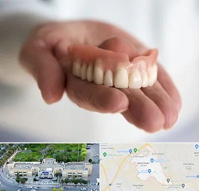 لیفت لثه با لیزر در نسیم شهر