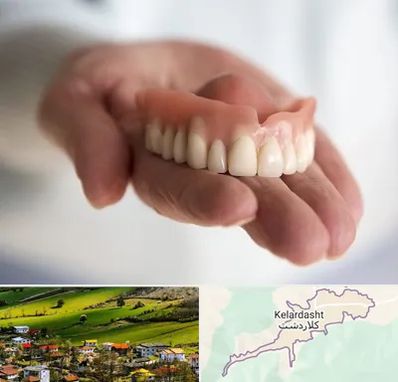 لیفت لثه با لیزر در کلاردشت