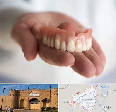 لیفت لثه با لیزر در ایرانشهر