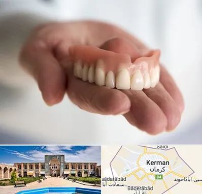 لیفت لثه با لیزر در کرمان