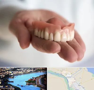 لیفت لثه با لیزر در خرمشهر