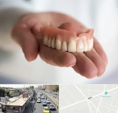 لیفت لثه با لیزر در خیابان دماوند