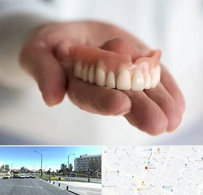 لیفت لثه با لیزر در بلوار کلاهدوز مشهد